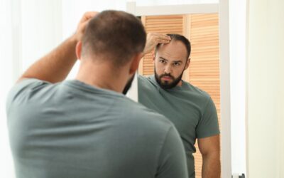 11 Expert Tips for Dealing with Receding Hairlines