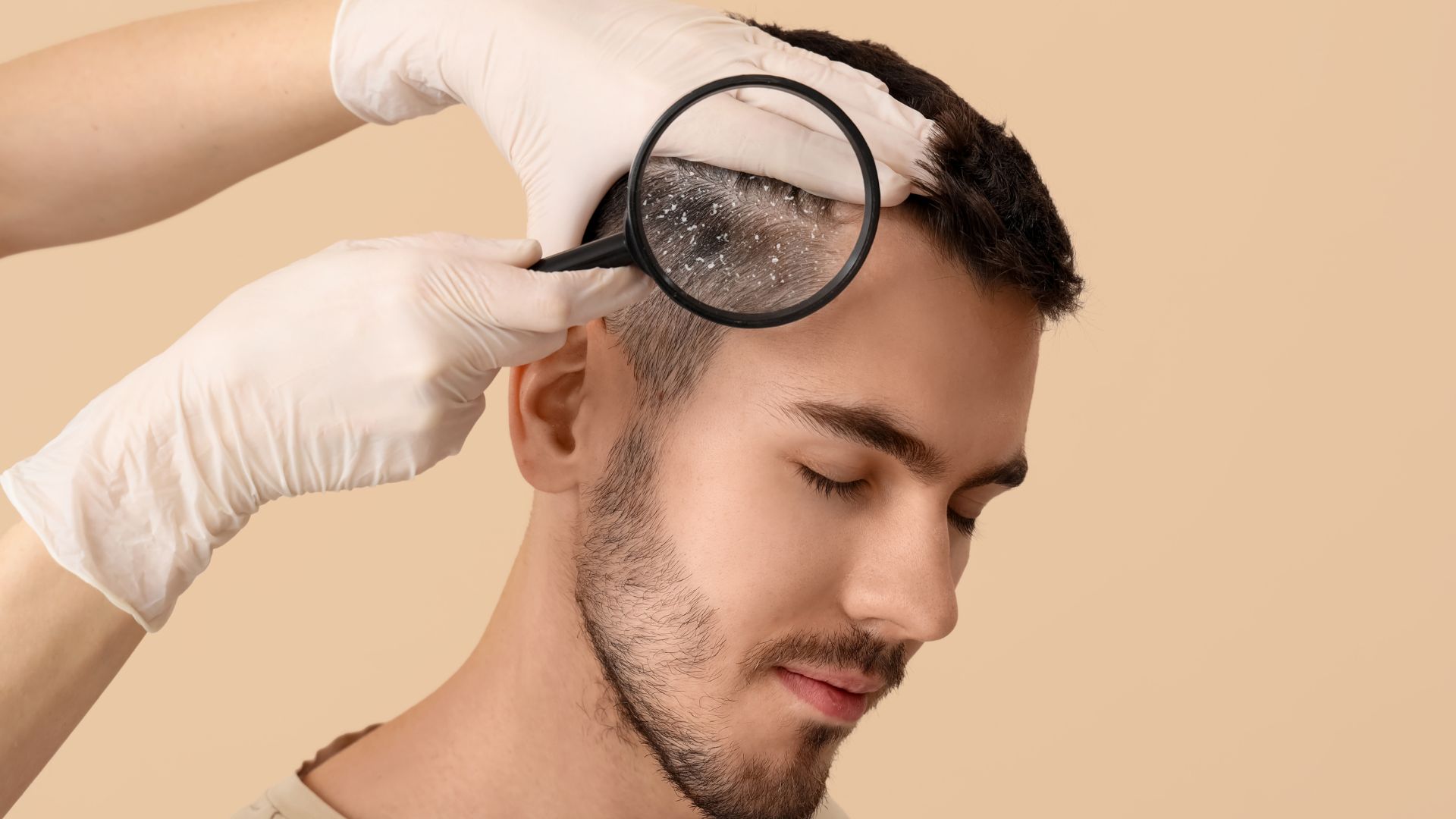 11 Ways to Keep Your Scalp Healthy During Winter