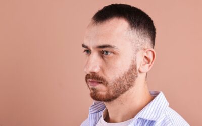 15 Haircuts for Receding Hairlines