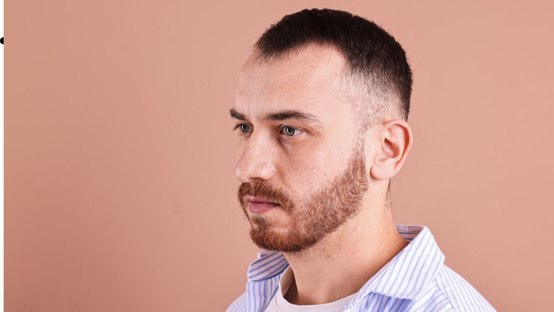 15 Haircuts for Receding Hairlines