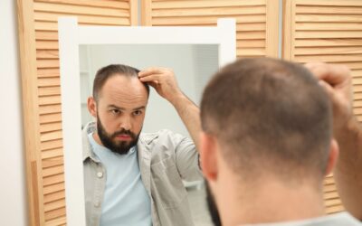 15 Short Hairstyles for Balding Men