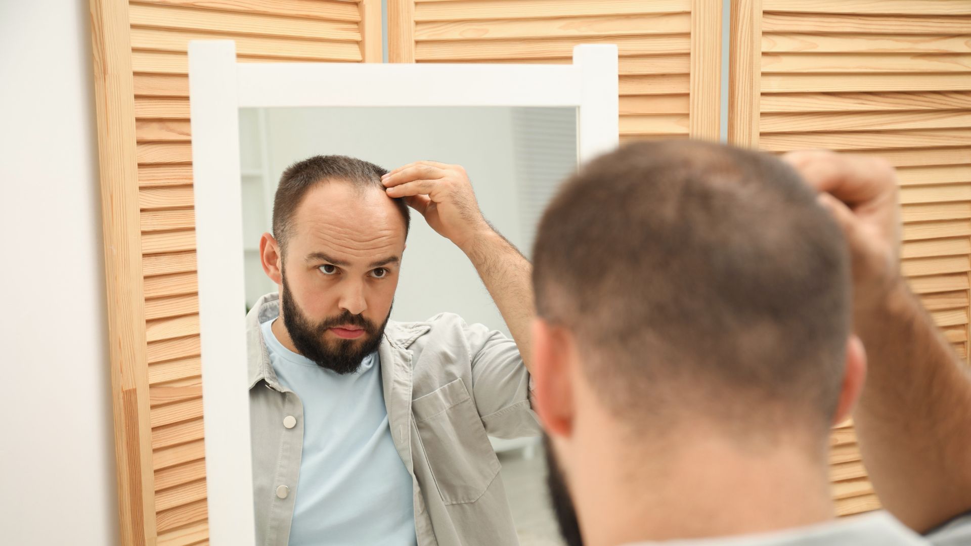 15 Short Hairstyles for Balding Men